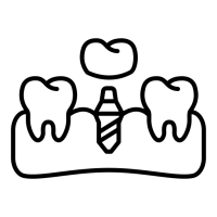 prothese-dentaire (2)